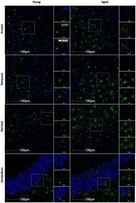 Astrocyte expression of aging-associated markers positively correlates with neurodegeneration in the frontal lobe of the rhesus macaque brain